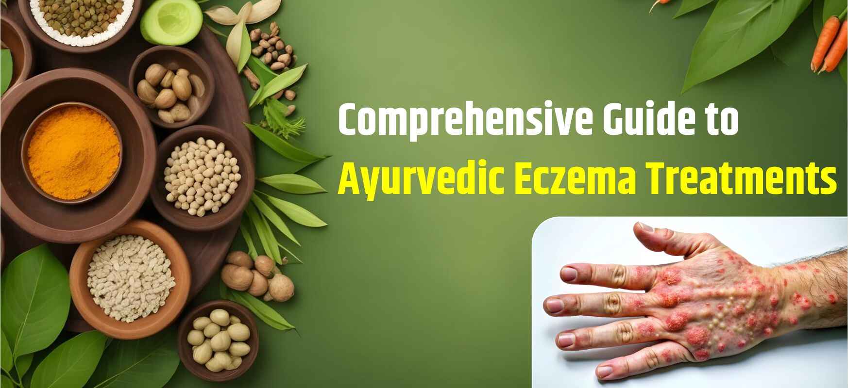 Comprehensive Guide to Ayurvedic Eczema Treatments